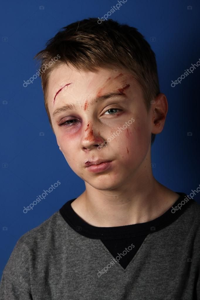 Kid found beat up in school bathroom
